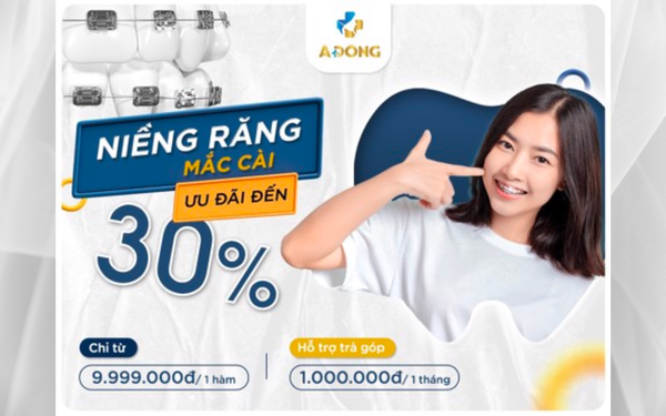 Niềng Răng Mắc Cài Giảm Giá Chỉ Còn 9.999.000đ / 1 Hàm