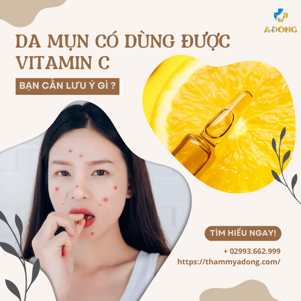 Da mụn dùng vitamin C được không? Cần lưu ý những gì?