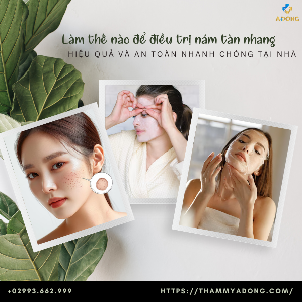 Làm thế nào để điều trị nám tàn nhang hiệu quả tại nhà?