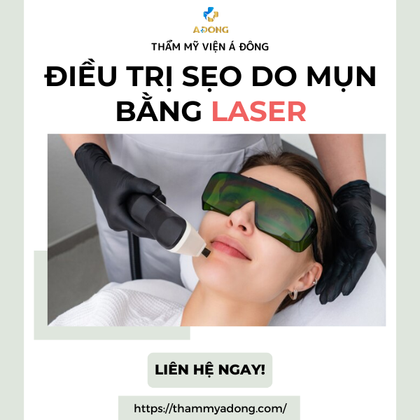 Phương pháp hiệu quả điều trị sẹo do mụn bằng laser
