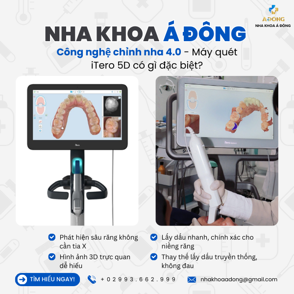 Công nghệ chỉnh nha 4.0: Máy quét iTero 5D có gì đặc biệt?
