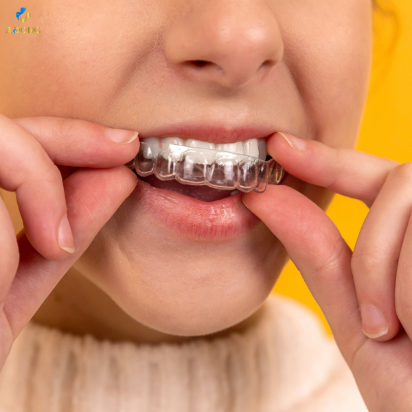 Niềng răng Invisalign First – Định hình nụ cười hoàn hảo cho trẻ nhỏ