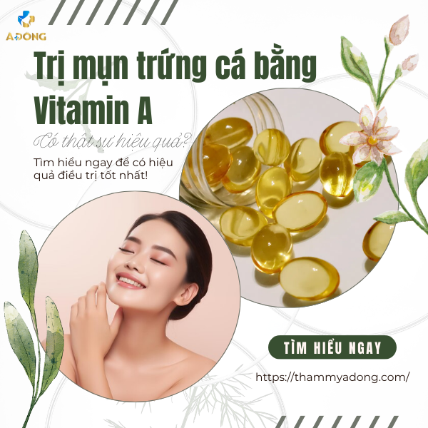 Trị mụn trứng cá bằng Vitamin A có thật sự hiệu quả?