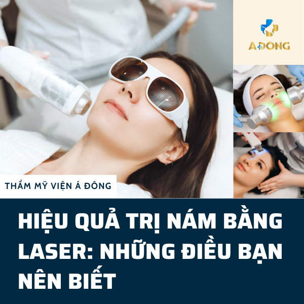 Hiệu quả trị nám bằng laser: Những điều bạn nên biết