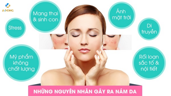 Trị Nám Hiệu Quả Tại Thẩm Mỹ Viện Á Đông