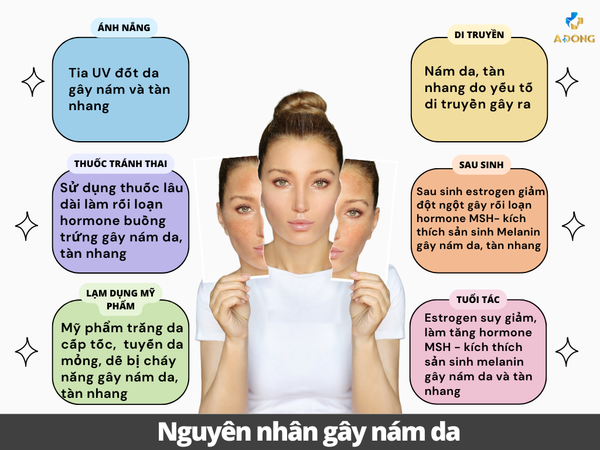 Giải đáp nguyên nhân gây nám da tại TMV Á Đông