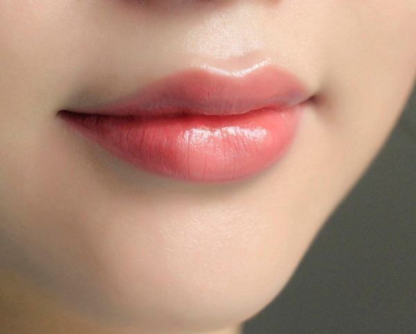 Khử thâm môi bằng tia laser - Thẩm mỹ Á Đông