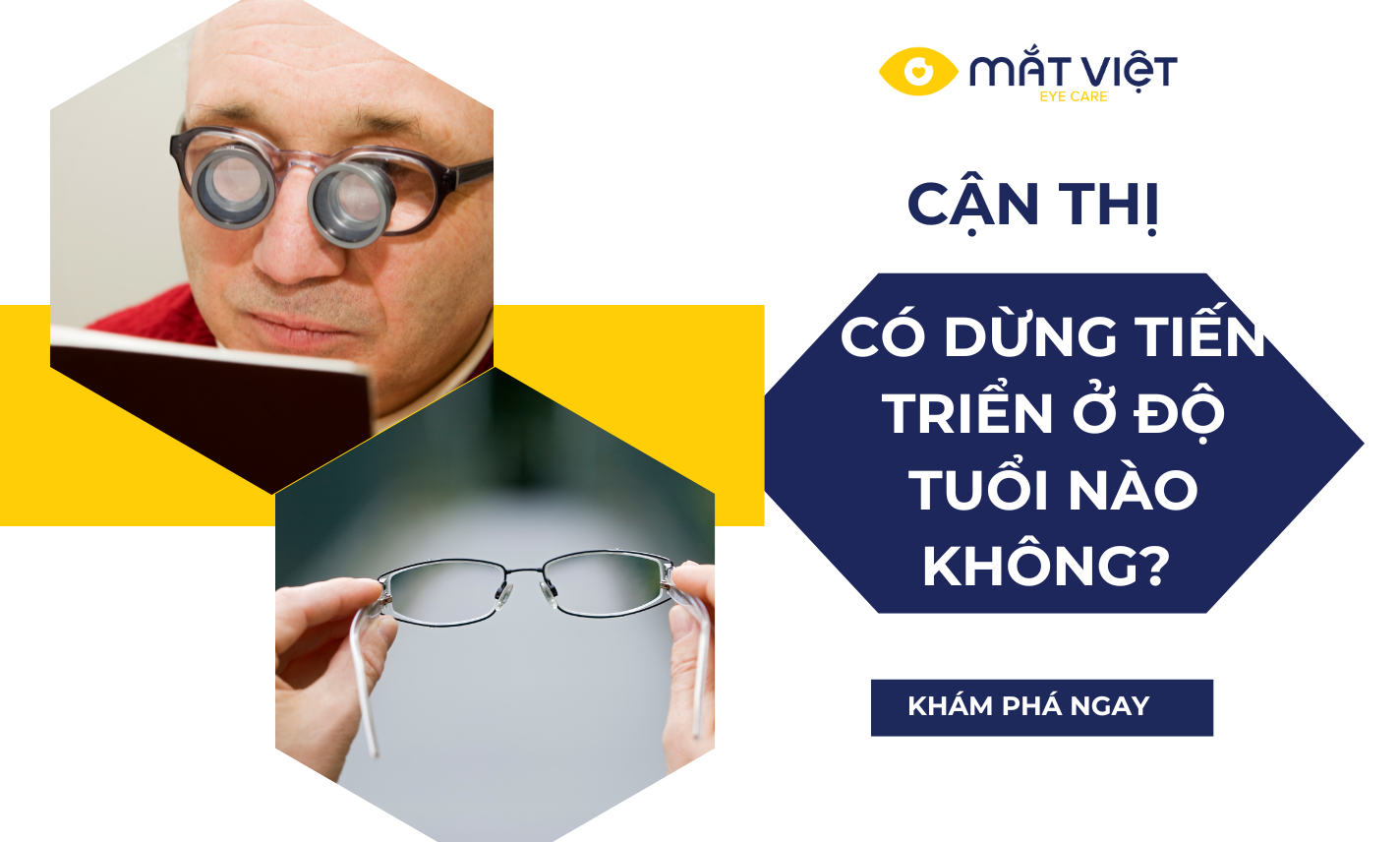 Cận thị có dừng tiến triển sau một độ tuổi nhất định không?