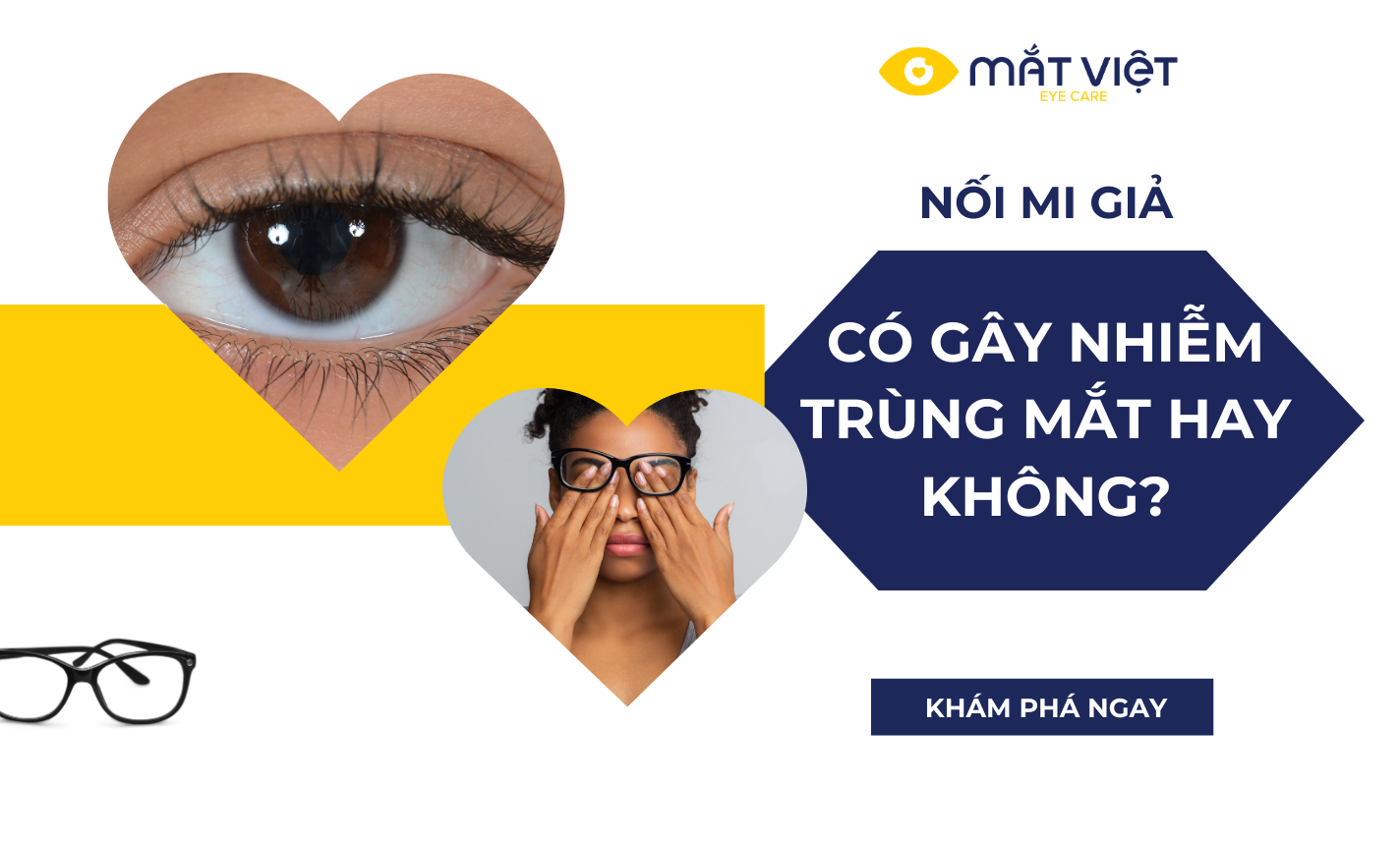 Nối mi giả có gây nhiễm trùng mắt không? Những điều bạn cần biết