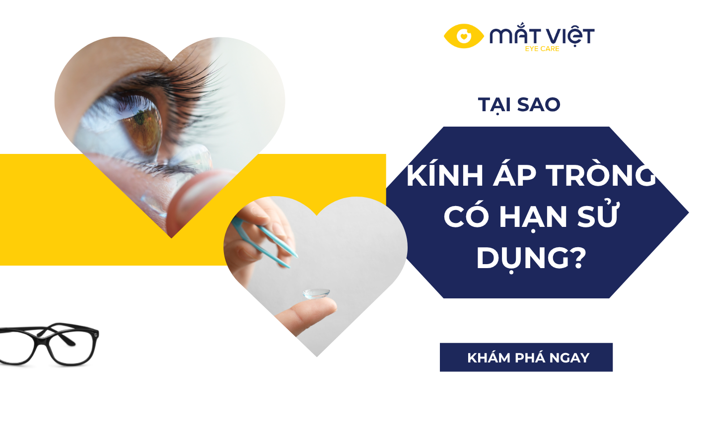 Tại sao kính áp tròng có hạn sử dụng?