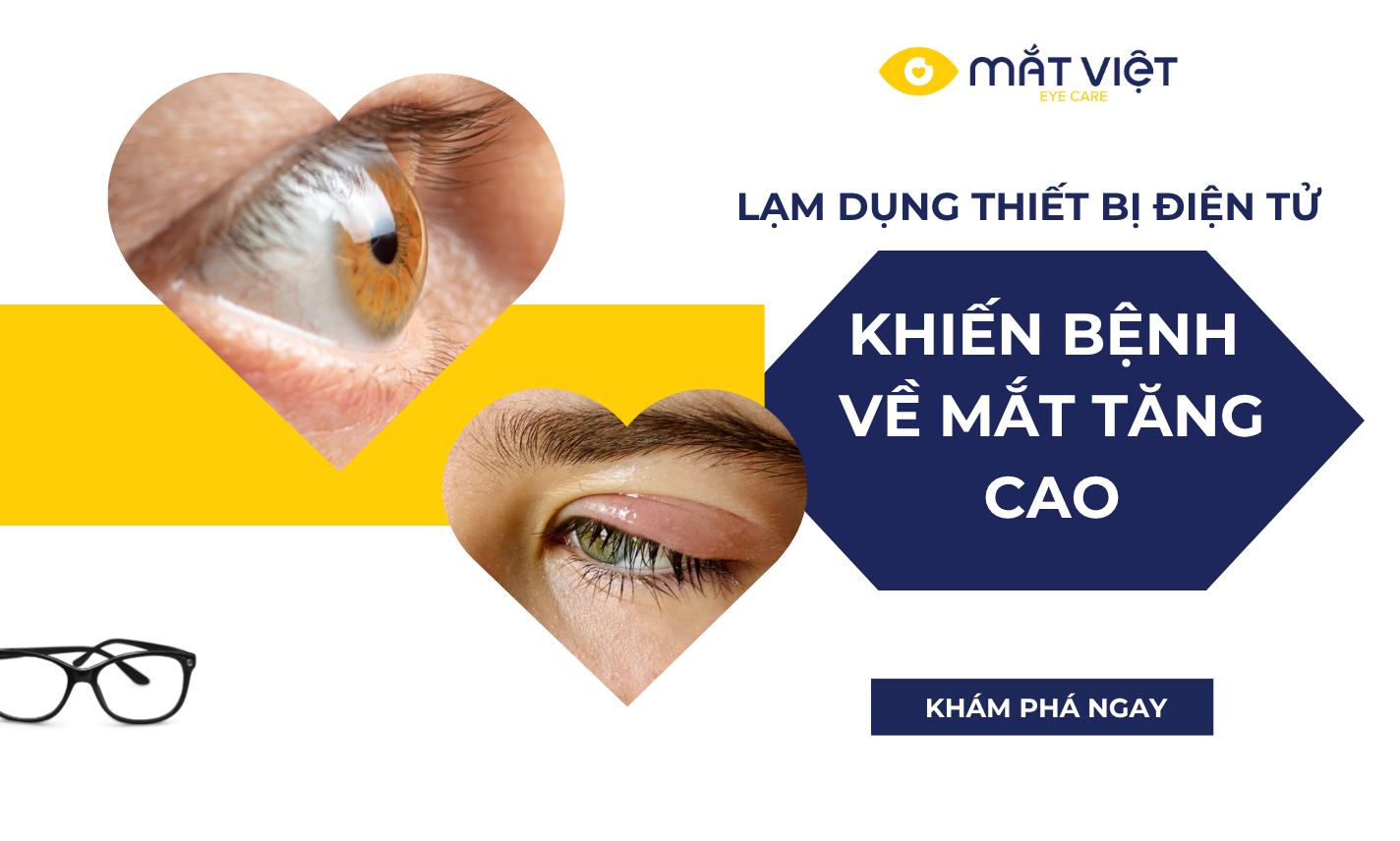 Cảnh báo lạm dụng thiết bị điện tử khiến bệnh về mắt tăng cao