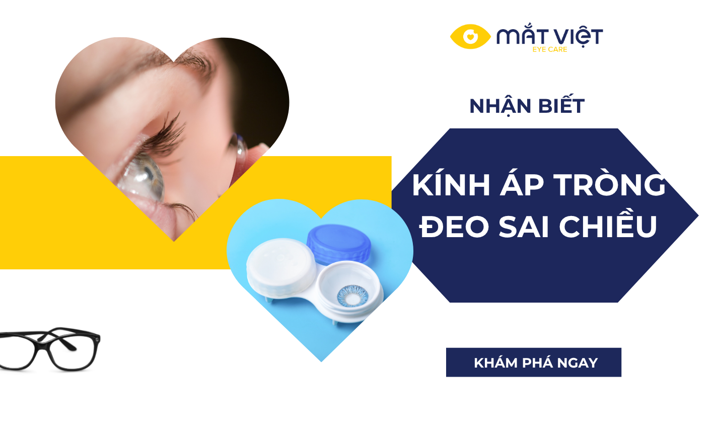 Nhận biết kính áp tròng bị lộn ngược và mẹo đeo đúng