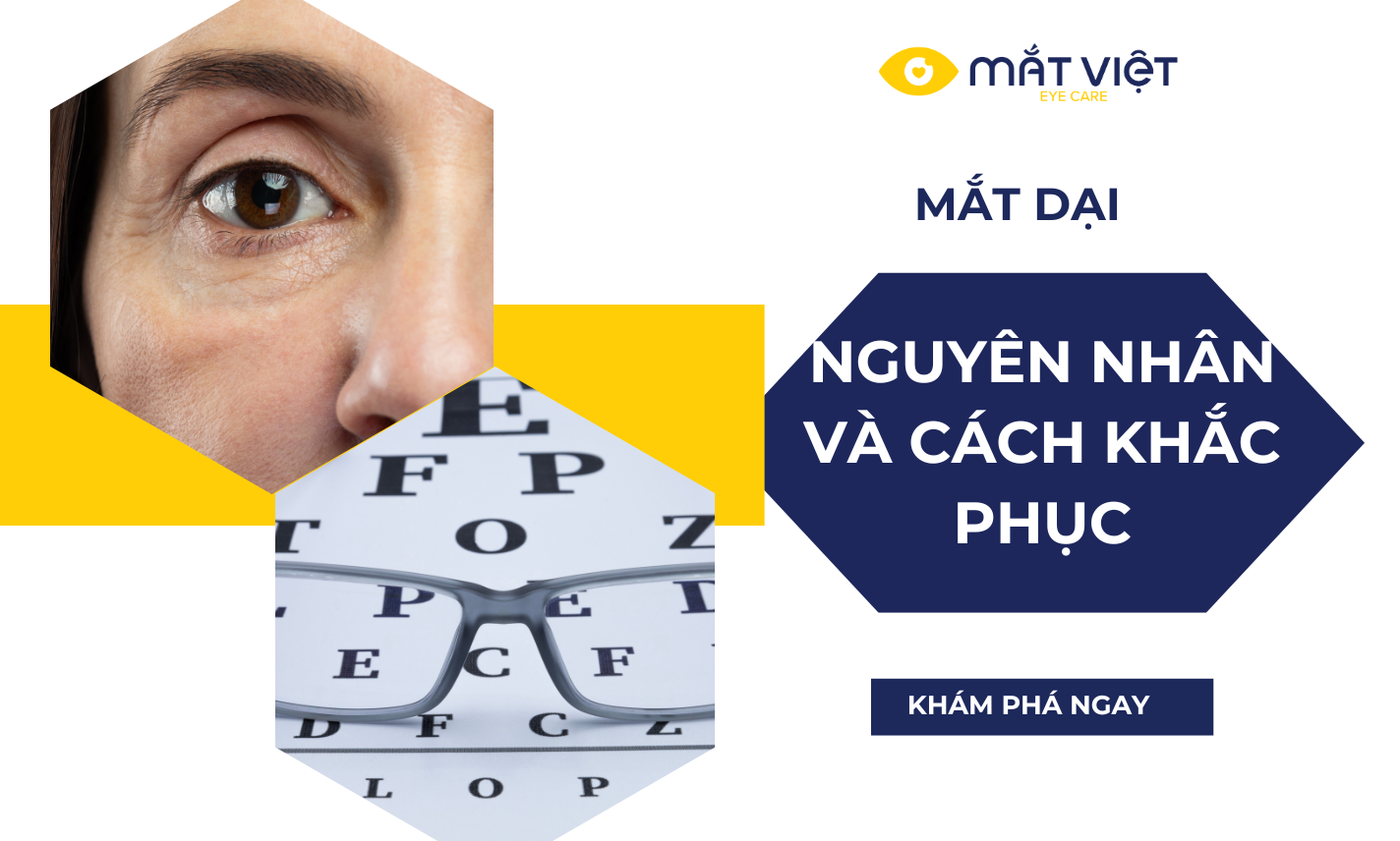 Nguyên nhân mắt dại và cách khắc phục