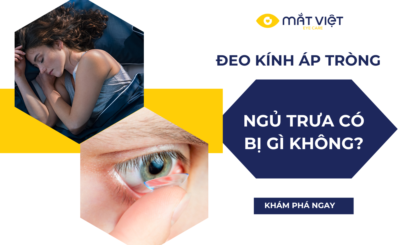 Đeo kính áp tròng ngủ trưa có sao không?