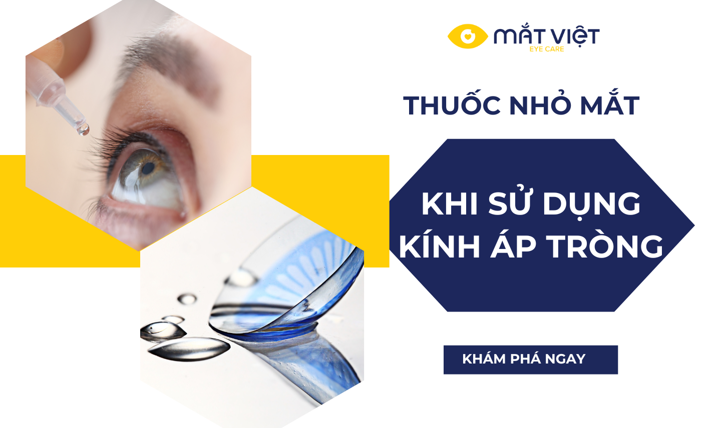 Khi đeo lens nên dùng thuốc nhỏ mắt nào?