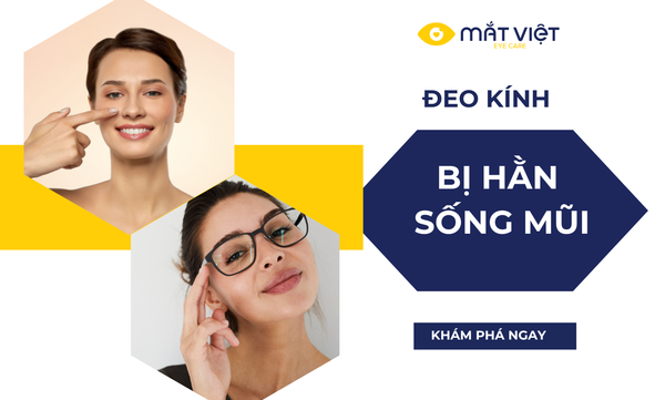 Đeo kính bị hằn sống mũi? Nguyên nhân và 5 cách khắc phục hiệu quả