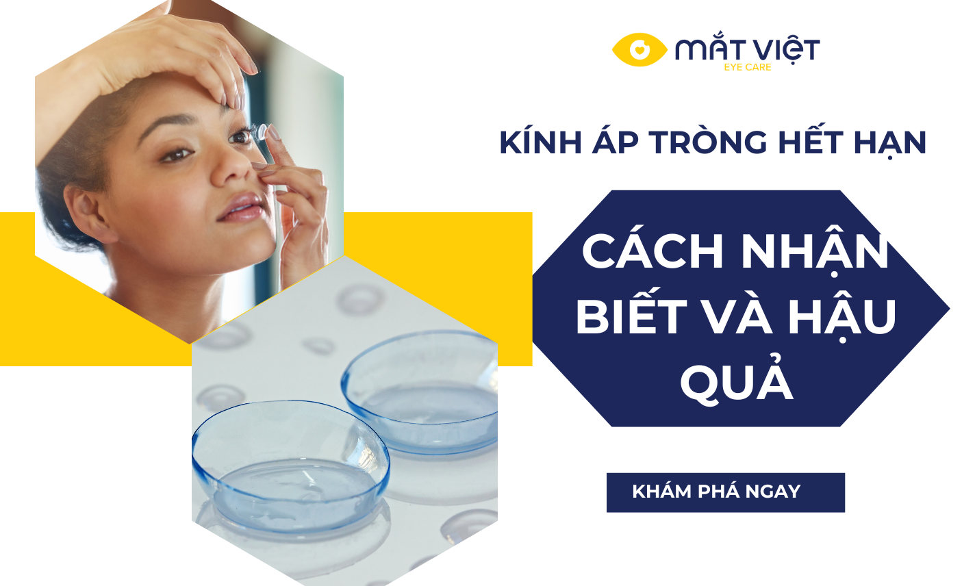 Đeo kính áp tròng hết hạn có nguy hiểm không?