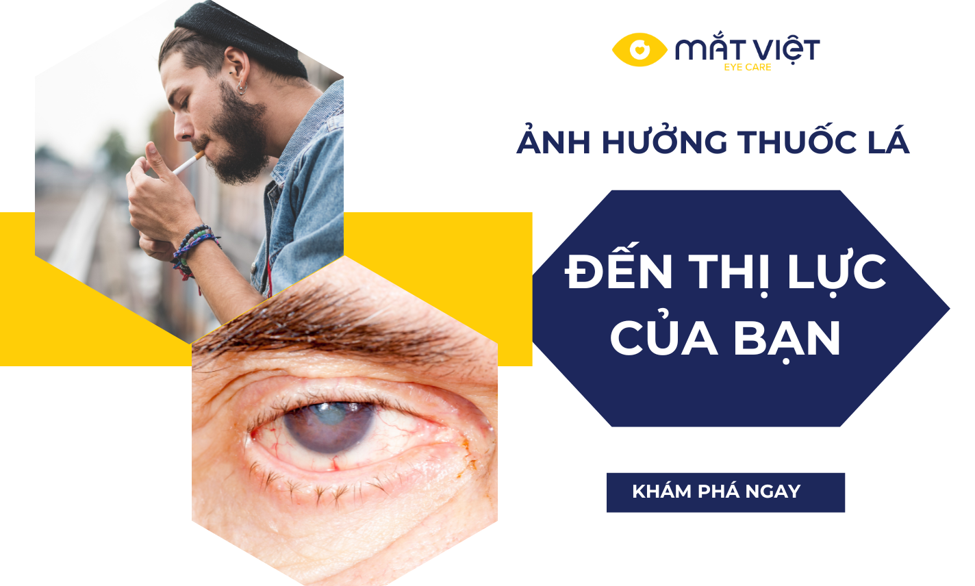 Ảnh hưởng của thuốc lá tới thị lực