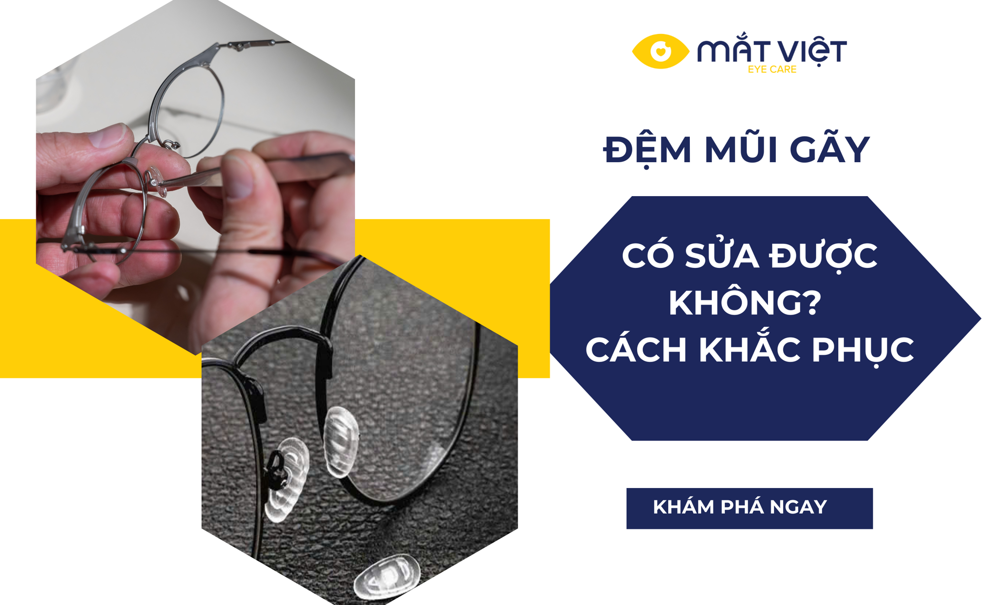 Sửa Mũi Gãy: Giải Pháp Khắc Phục Hiệu Quả Để Lấy Lại Tự Tin