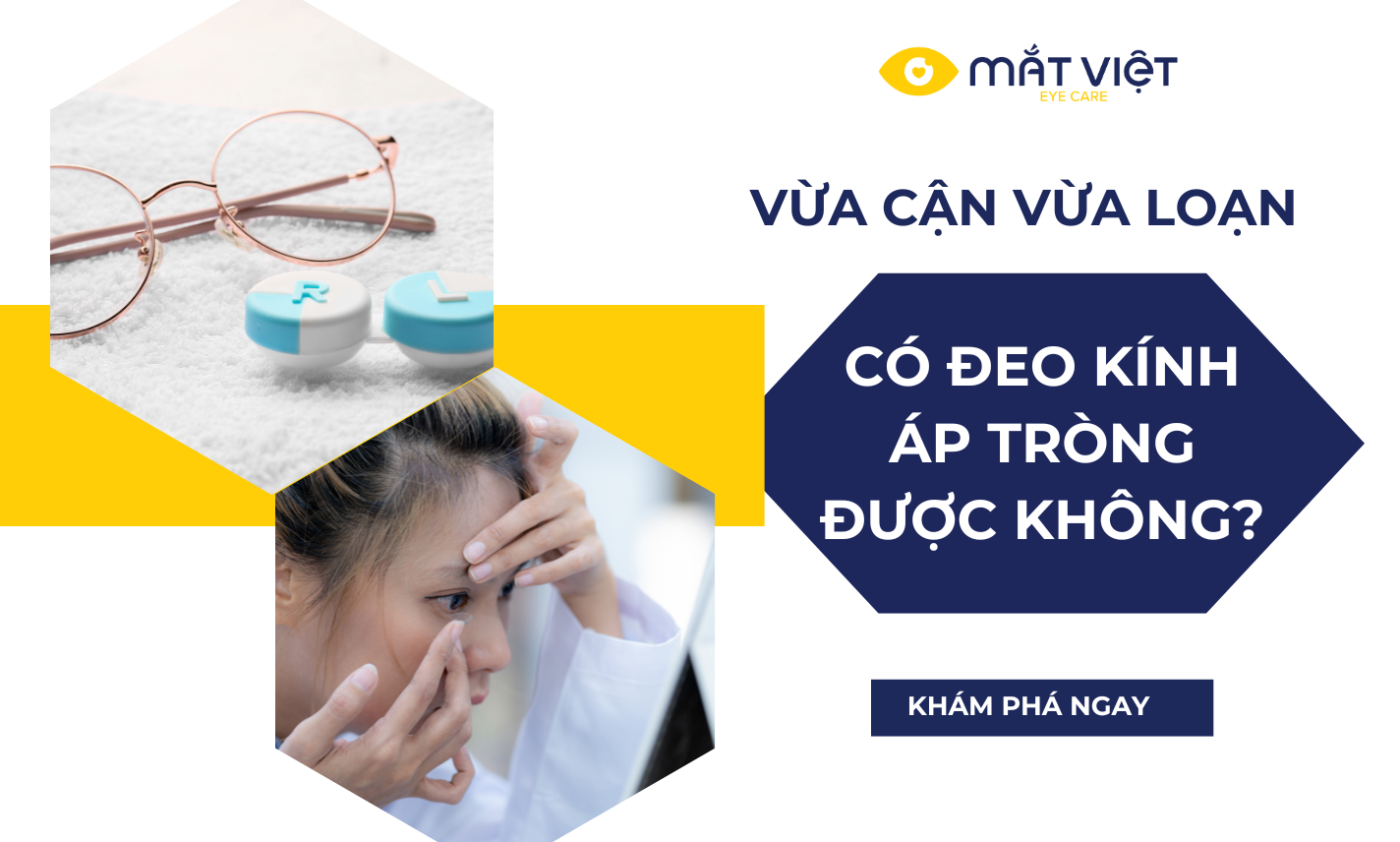 VỪA CẬN VỪA LOẠN CÓ ĐEO KÍNH ÁP TRÒNG ĐƯỢC HAY KHÔNG?