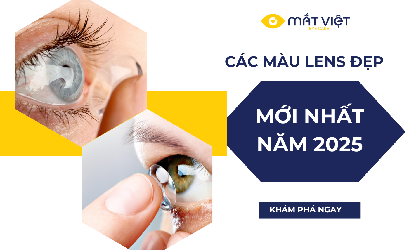 Tổng hợp lens mắt đẹp, ưa chuộng nhất năm 2025