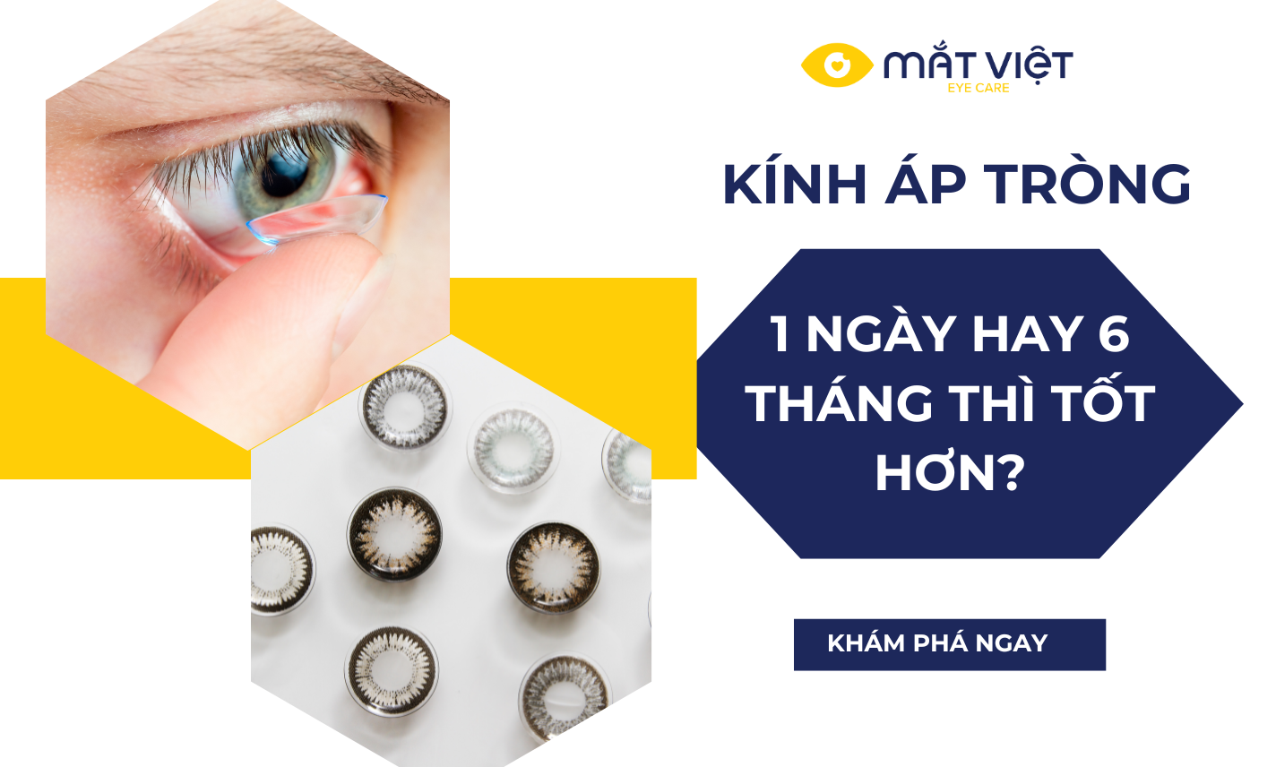 Nên chọn kính áp tròng 1 ngày hay kính áp tròng 6 tháng?