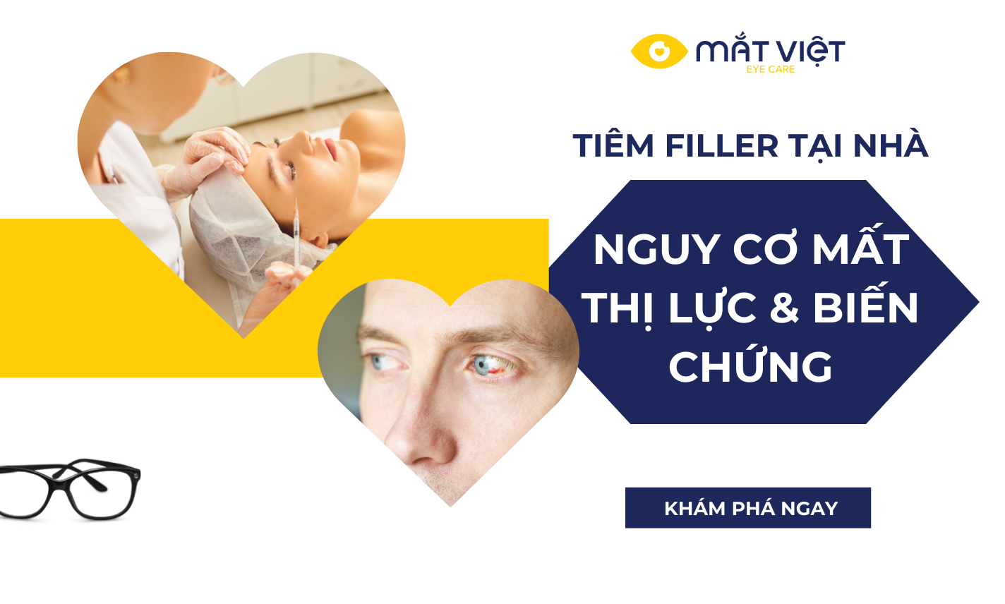 Tiêm filler tại nhà - Nguy cơ mất thị lực và những biến chứng nguy hiểm