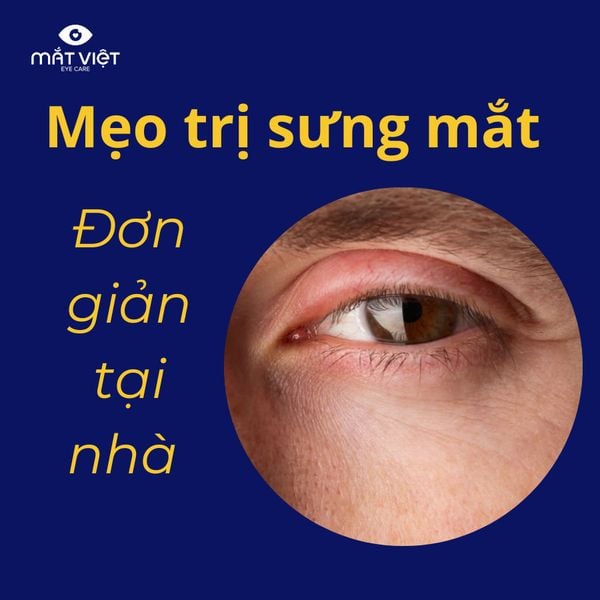 Mẹo trị sưng mắt đơn giản tại nhà
