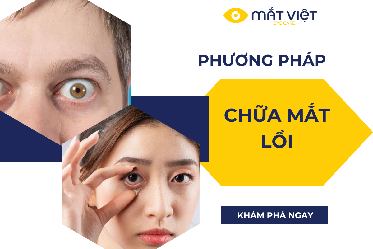 Phương pháp chữa mắt lồi hiệu quả