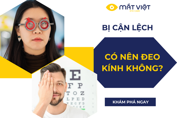 Bị cận lệch có nên đeo kính thường xuyên không?