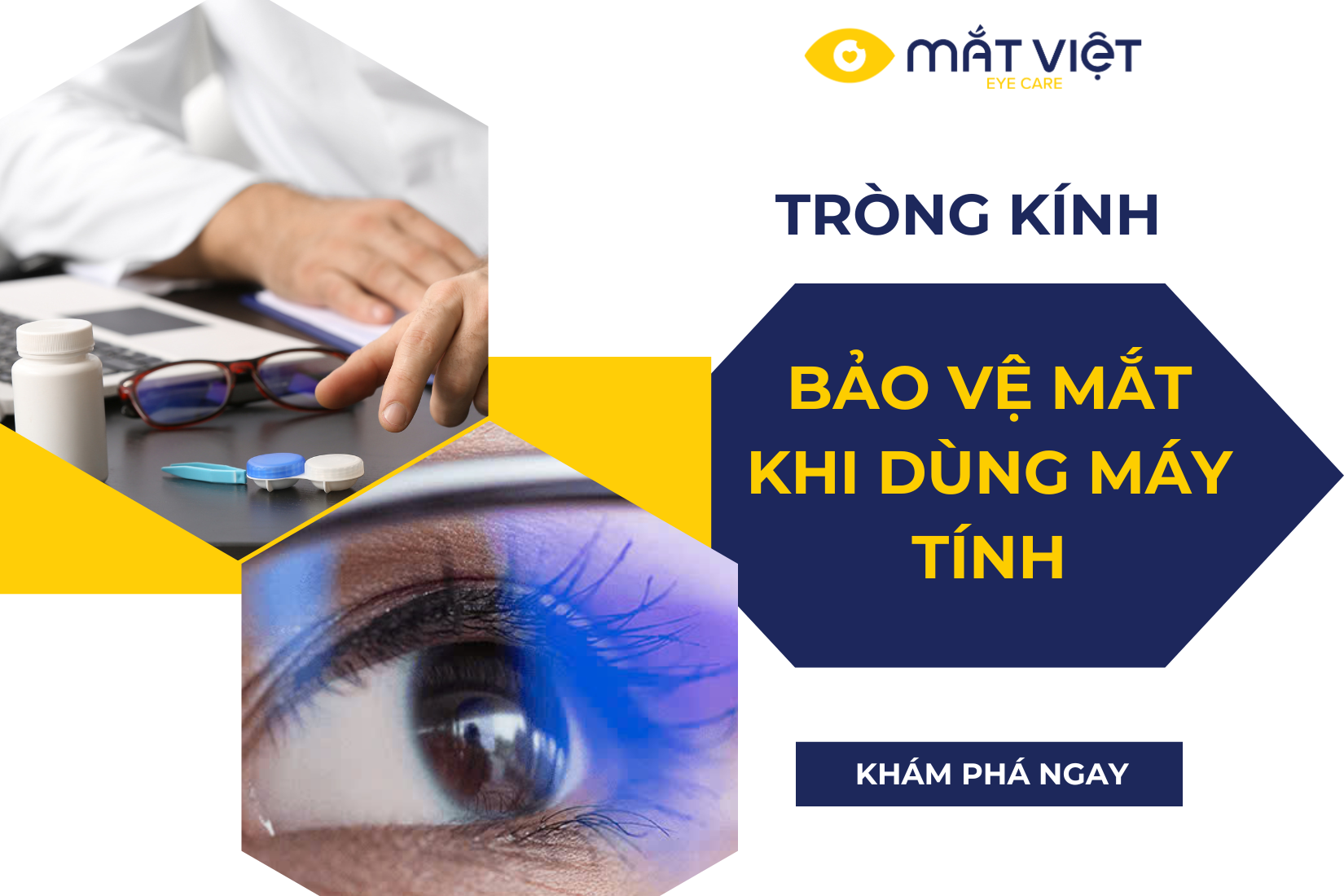 Tròng kính bảo vệ mắt khi dùng máy tính