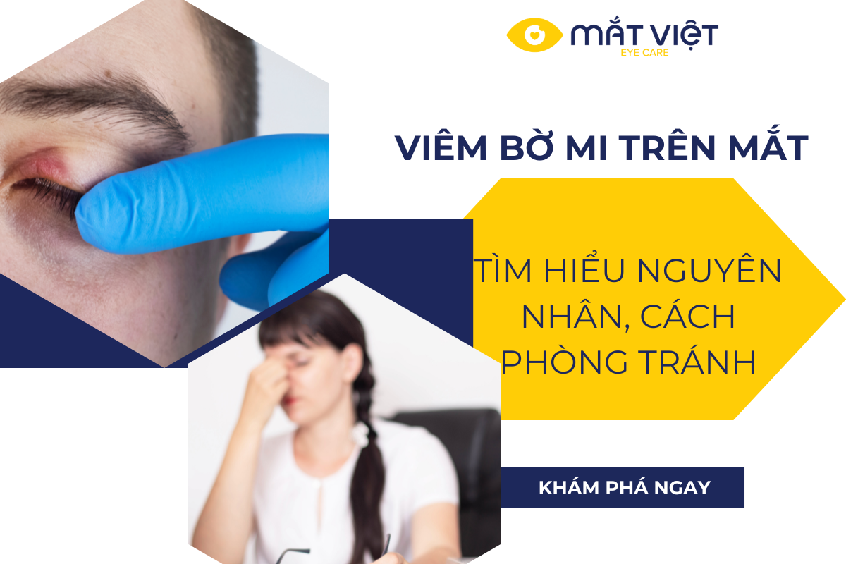 VIÊM BỜ MI TRÊN MẮT - NGUYÊN NHÂN, TRIÊU CHỨNG VÀ ĐIỀU TRỊ TOÀN DIỆN