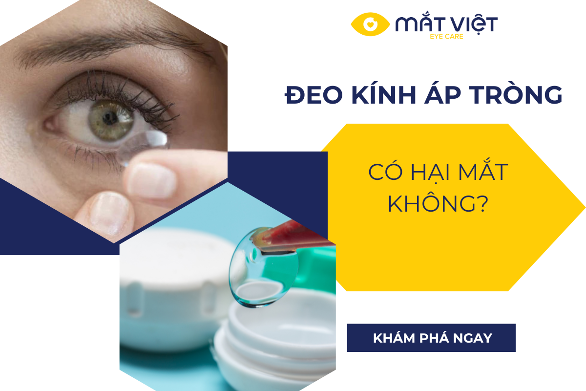 Đeo kính áp tròng có hại mắt không?