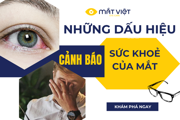 NHỮNG DẤU HIỆU CẢNH BÁO VỀ SỨC KHOẺ MẮT KHÔNG THỂ BỎ QUA