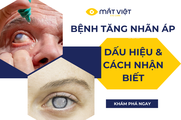 BỆNH TĂNG NHÃN ÁP - DẤU HIỆU VÀ CÁCH NHẬN BIẾT SỚM