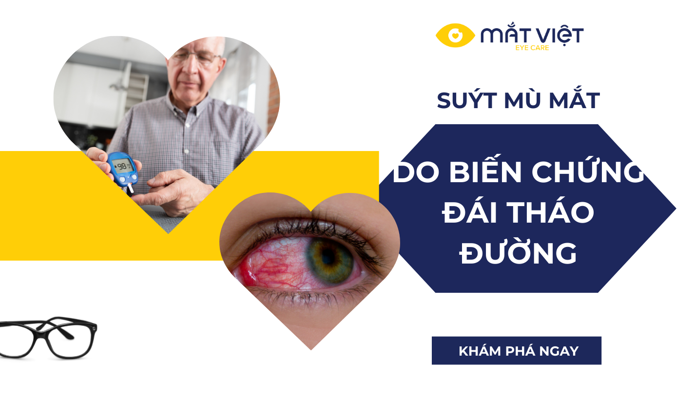 Suýt mù mắt do biến chứng từ bệnh đái tháo đường