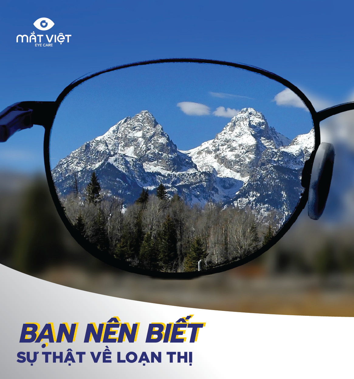 Sự thật về loạn thị bạn nên biết