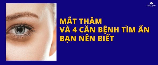 Mắt thâm và 4 căn bệnh tìm ẩn bạn nên biết