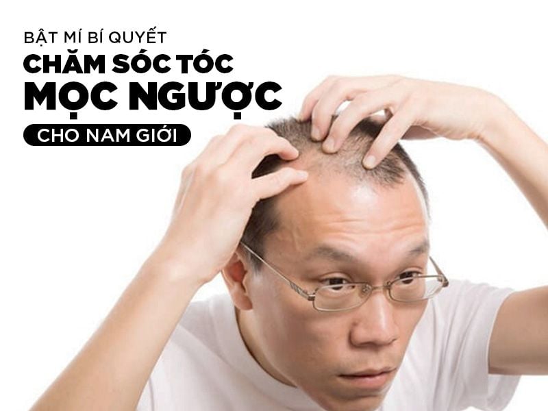 Bật Mí Bí Quyết Chăm Sóc Tóc Mọc Ngược Cho Nam Giới
