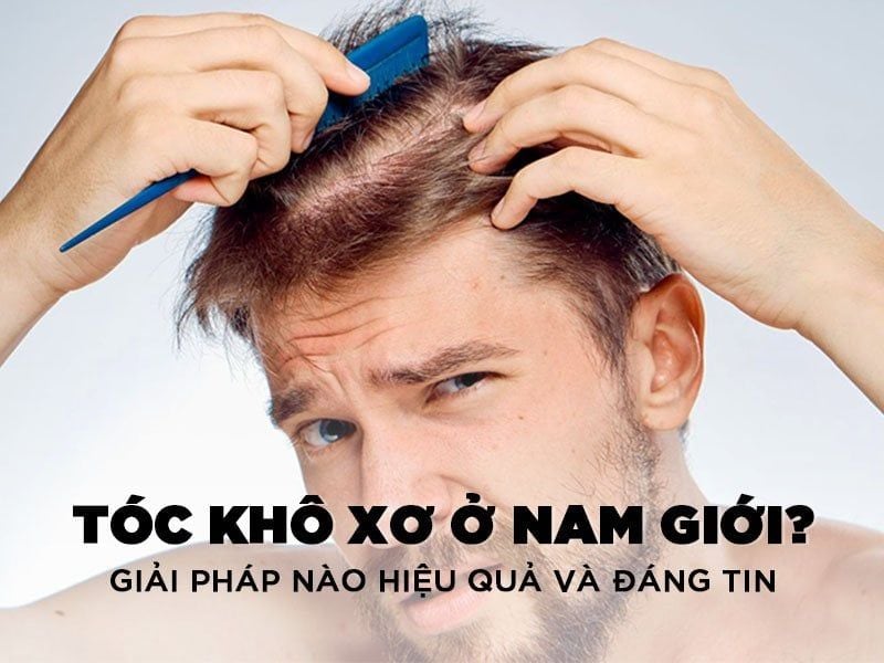 TÓC KHÔ XƠ Ở NAM GIỚI ? GIẢI PHÁP NÀO HIỆU QUẢ VÀ ĐÁNG TIN