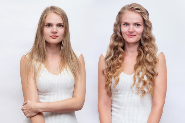 12+ Cách Kích Thích Mọc Tóc Nhanh, Dễ Áp Dụng Tại Nhà