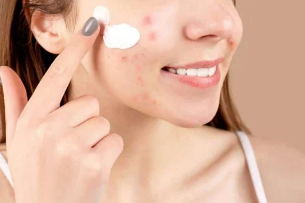 Quy trình các bước skincare cho da dầu mụn tuổi dậy thì buổi tối