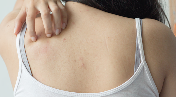 Những điều cần biết khi sử dụng sữa dưỡng thể bạn nên biết