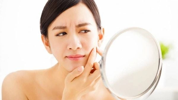 Tuyệt đối không tự ý nặn mụn