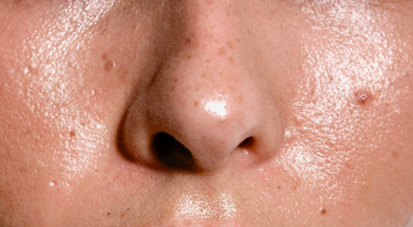 cấp ẩm cho da mặt