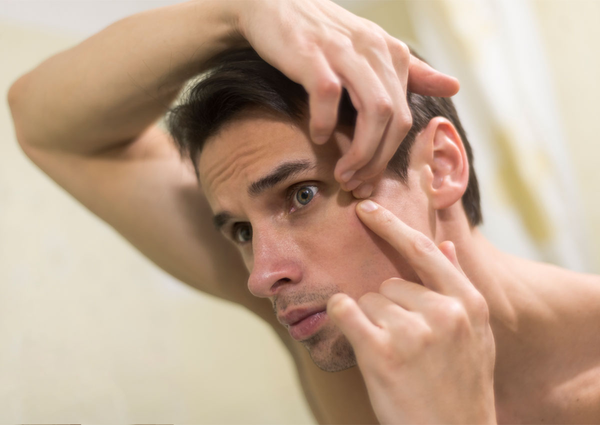 Mỗi một tình trạng da sẽ có những cách chăm sóc da khác nhau