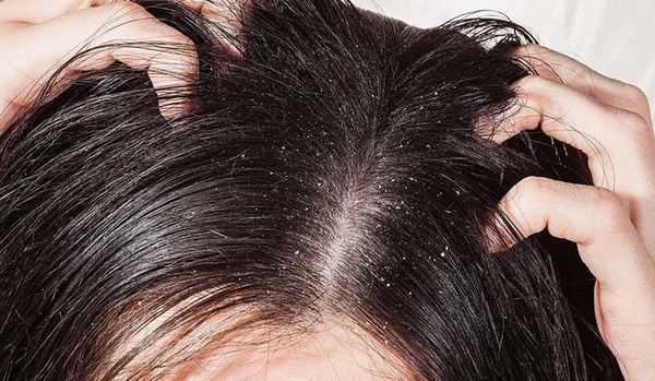 gội đầu hàng ngày có tốt không