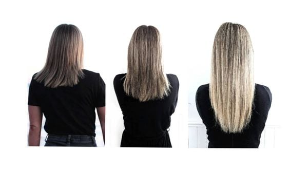 kích thích mọc tóc