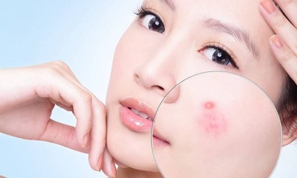massage mặt