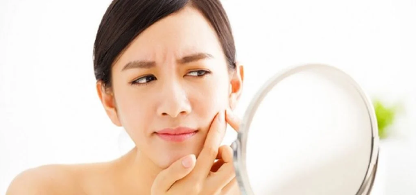 mụn ẩn là mụn gì